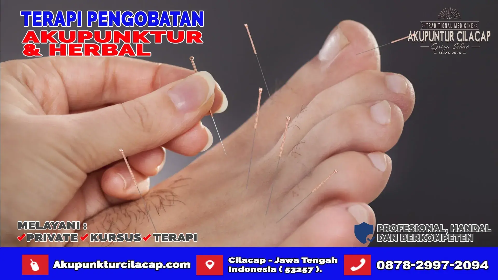 Jasa Pengobatan Akupuntur di Dayeuhluhur Cilacap