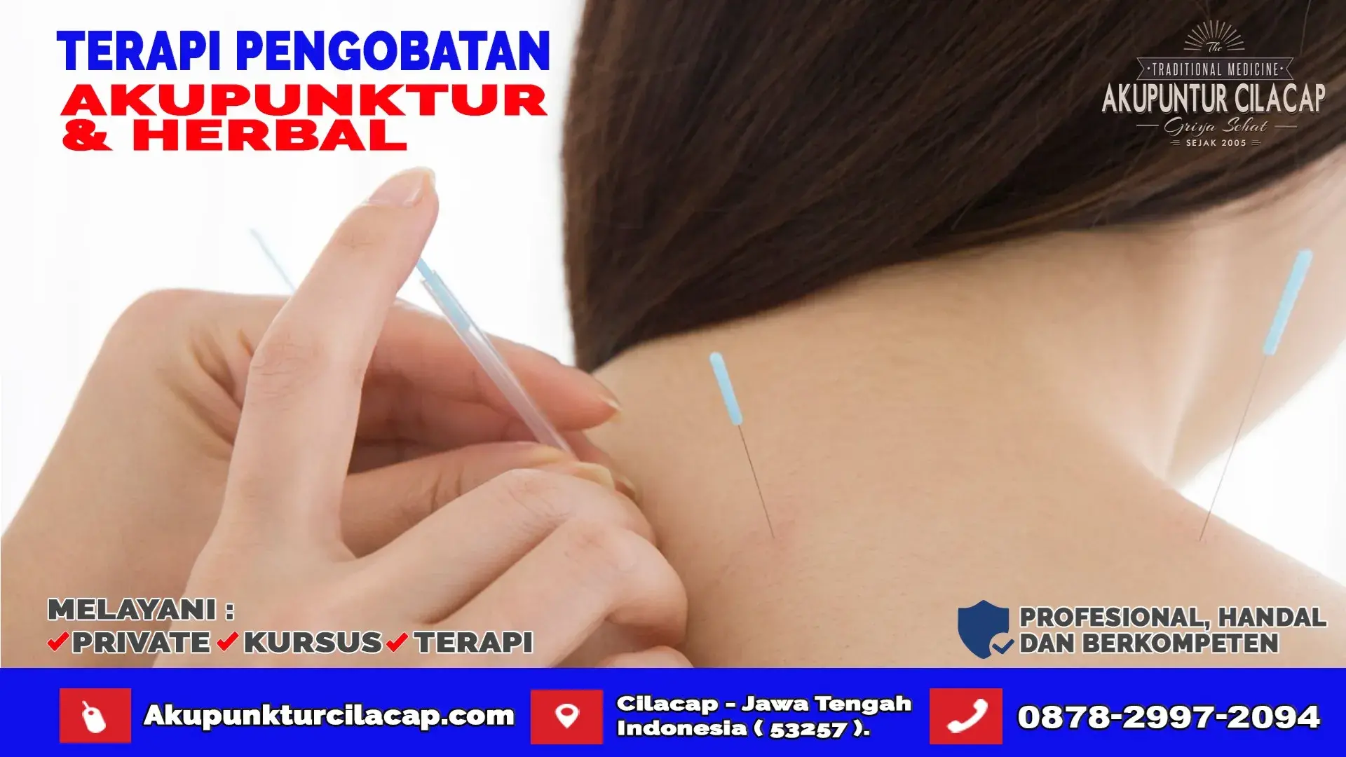 Jasa Terapi Akupuntur di Cipari Cilacap