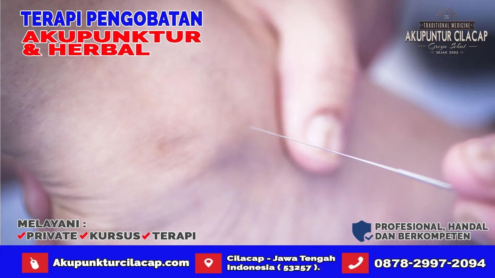 Klinik Terapi Akupuntur di Karangpucung Cilacap