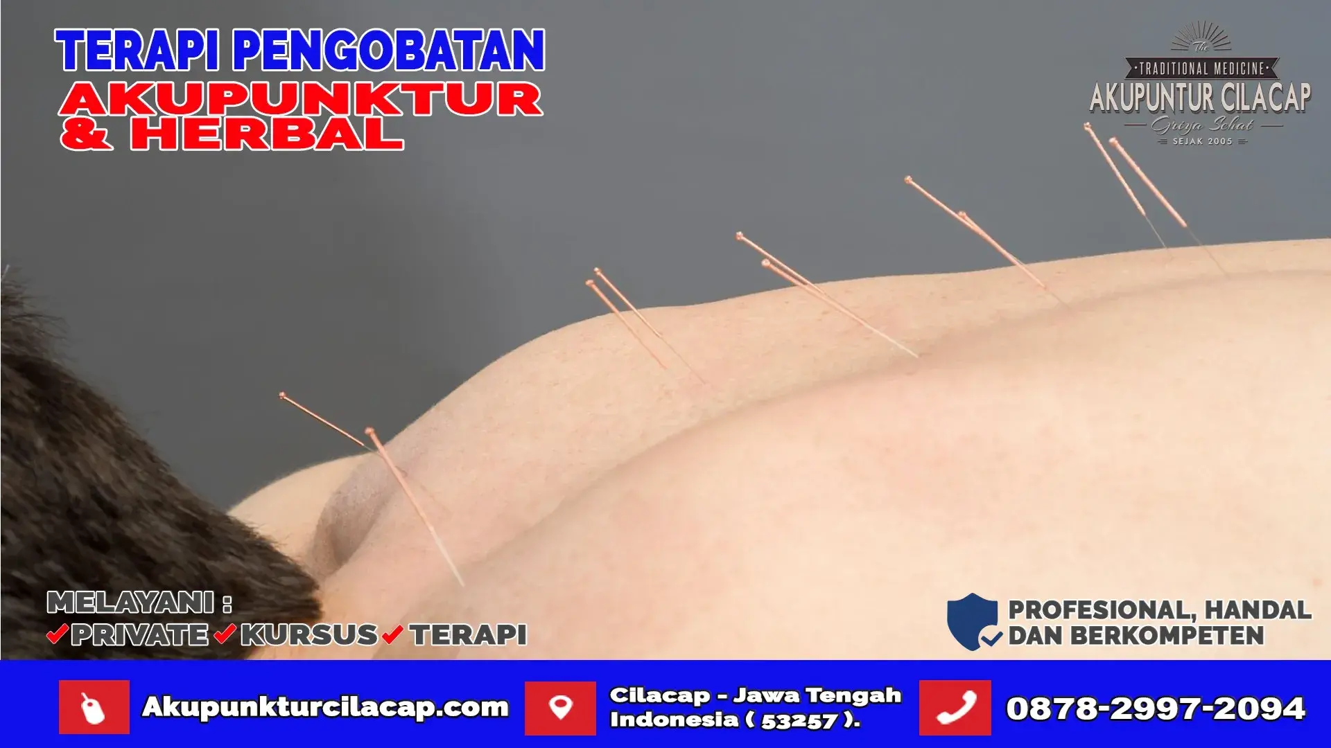 Praktik Terapi Akupunktur di Kedungreja
