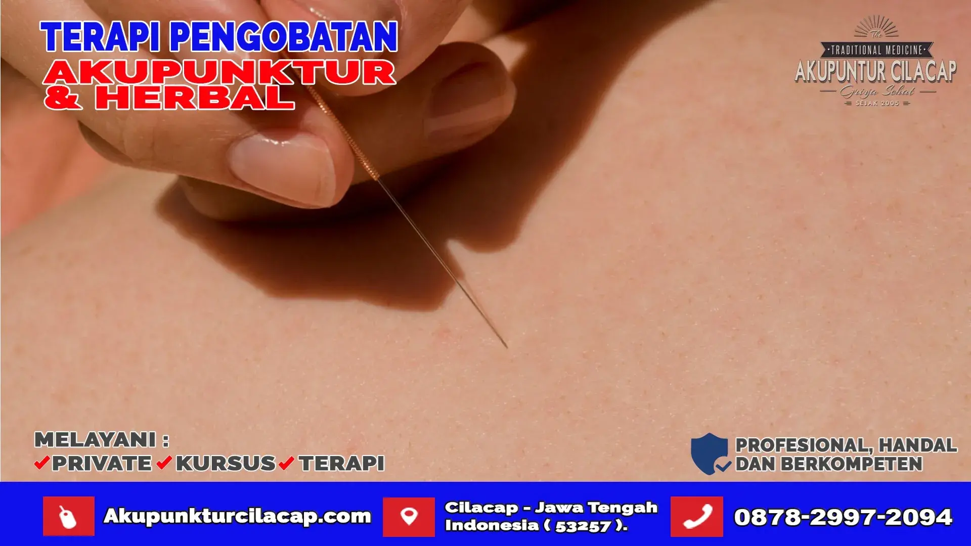Praktik Terapi Akupunktur di Kedungreja