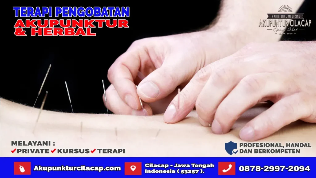 Terapi Akupuntur Di Cimanggu