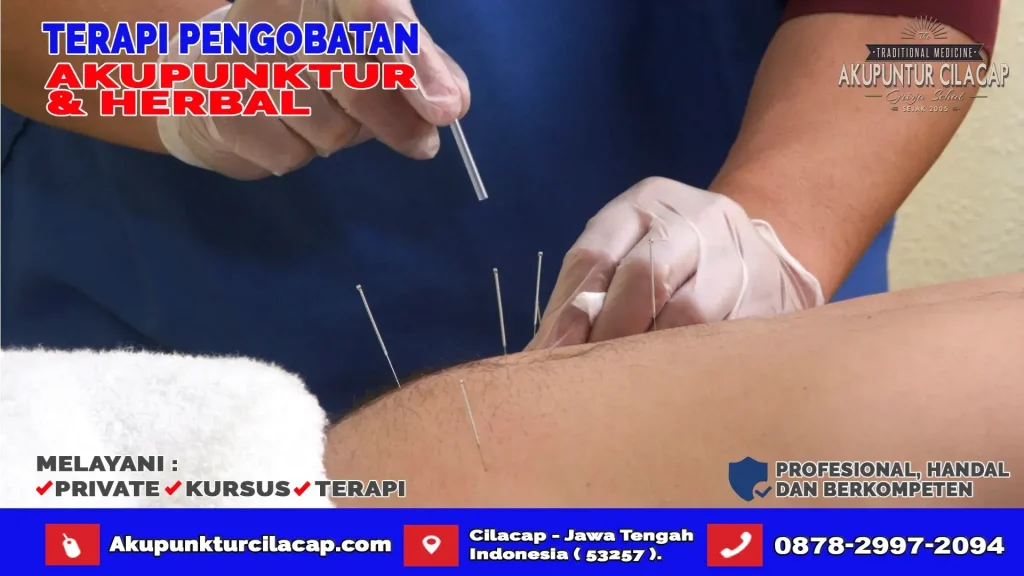 Terapi Akupuntur Di Cimanggu