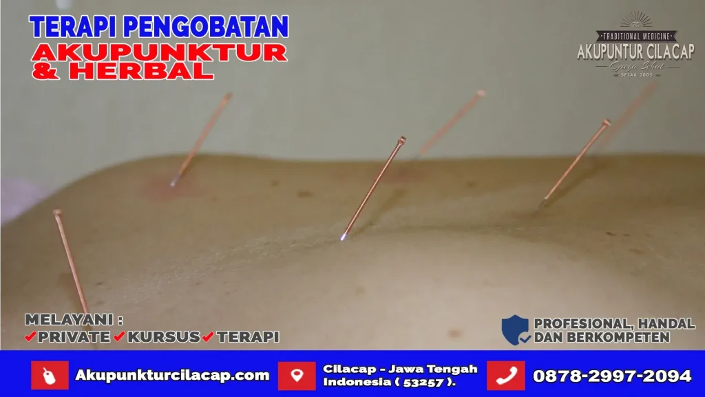 Terapi Akupuntur Di Cimanggu