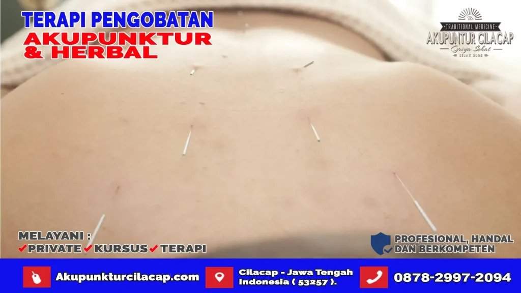 Terapi Akupuntur Di Cimanggu