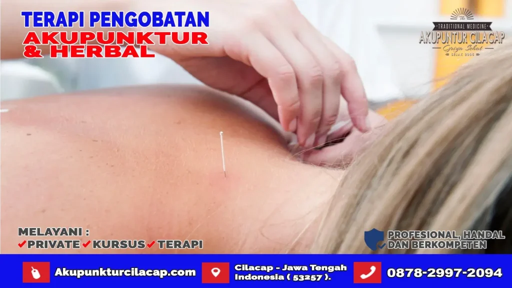 Terapi Akupuntur di Cipari