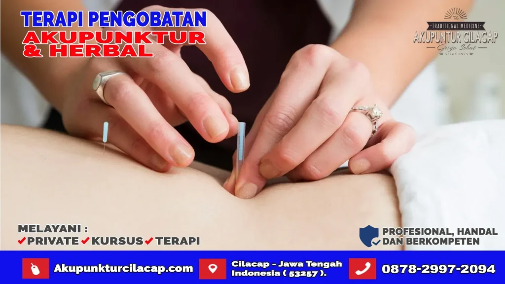 Terapi Akupuntur di Cipari