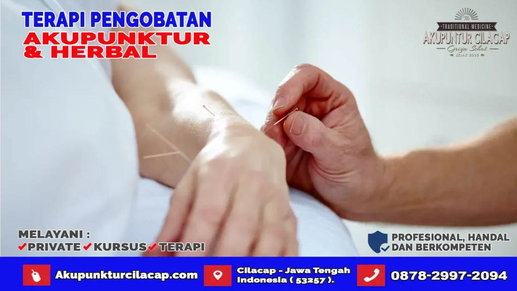 Terapi Akupuntur di Gandrungmangu