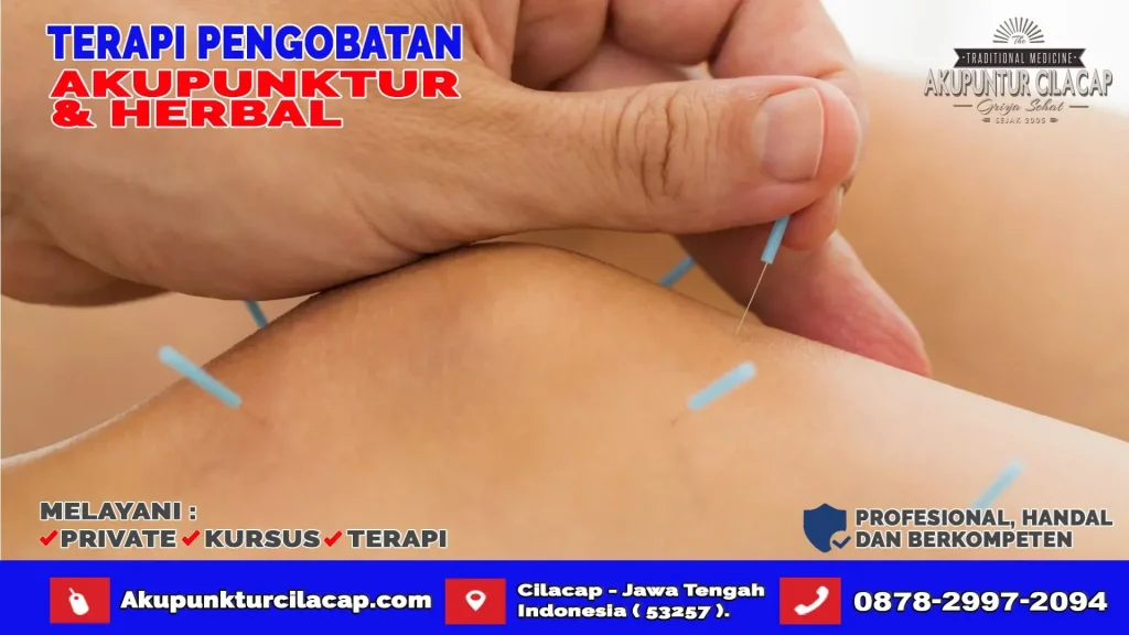 Terapi Akupuntur di Gandrungmangu