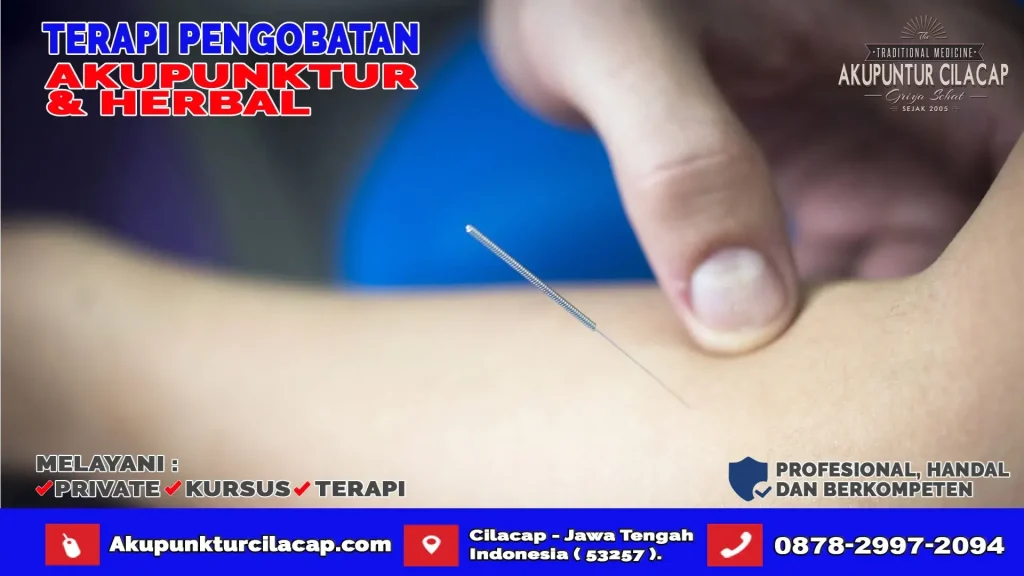 Terapi Akupuntur di Gandrungmangu
