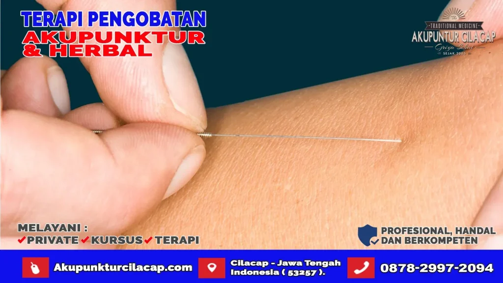 Terapi Akupuntur di Karangpucung