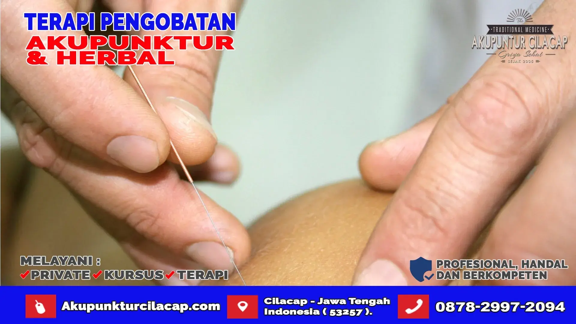 Terapi Akupuntur di Karangpucung