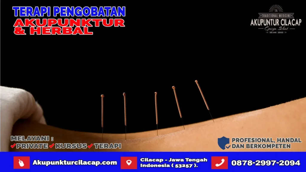 Terapi Akupuntur di Karangpucung