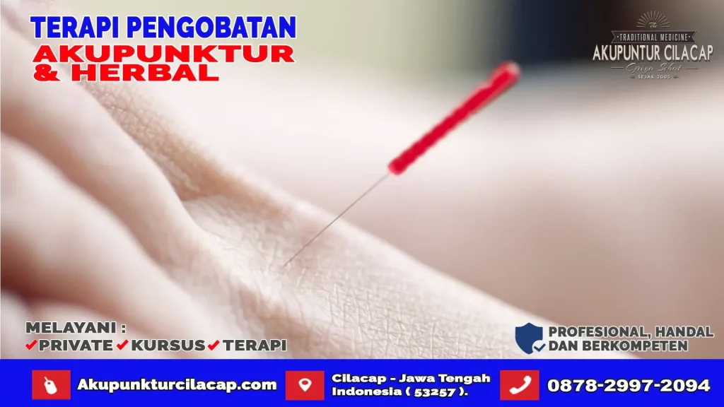 Terapi Akupuntur di Wanareja
