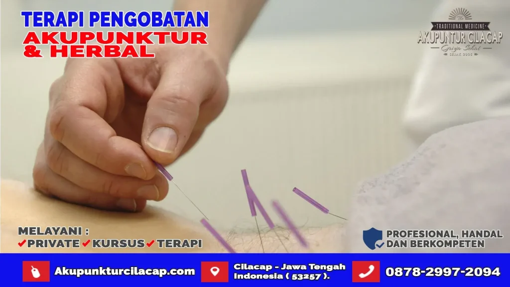 Terapi Akupuntur di Wanareja
