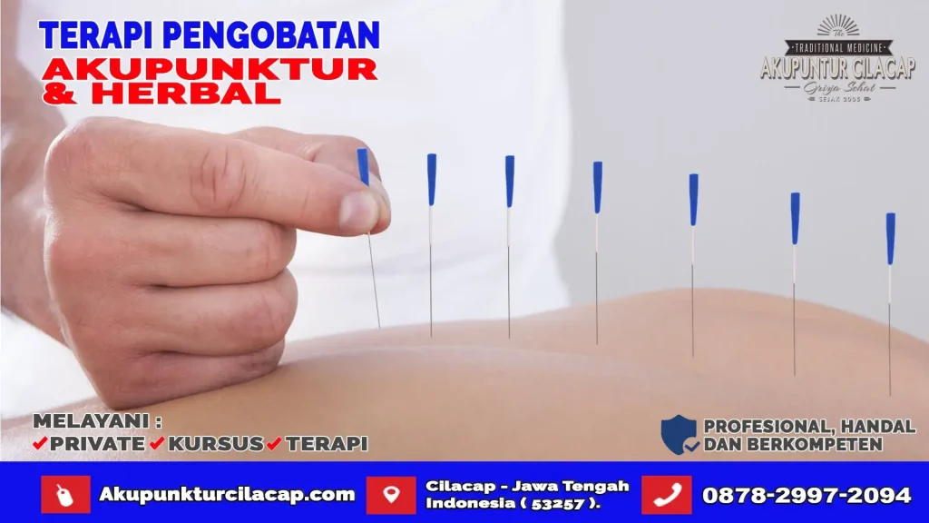 Terapi Akupuntur di Wanareja