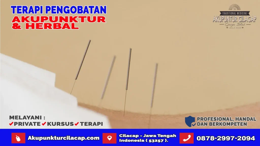 Terapi Akupuntur di Wanareja