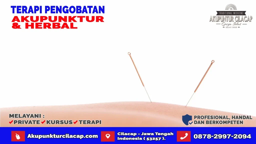 Terapi Akupuntur Di Cimanggu