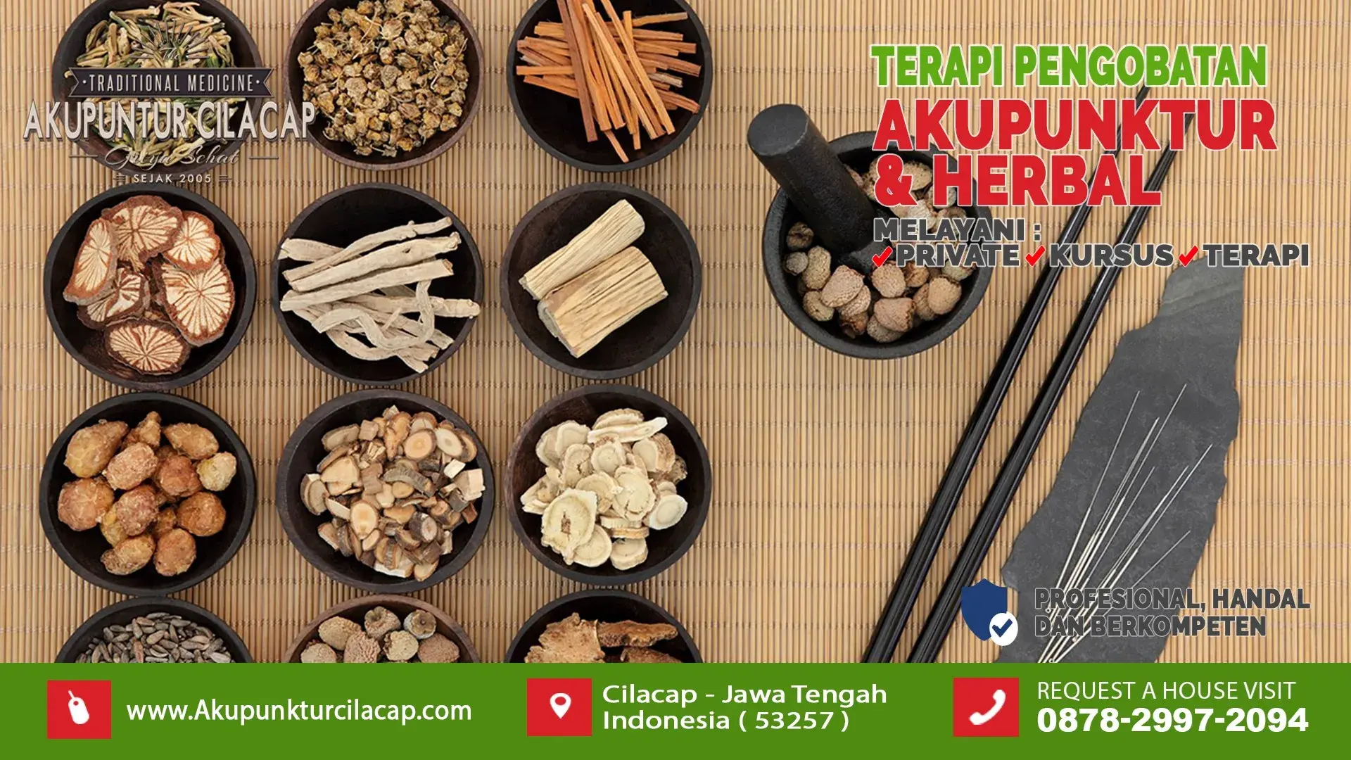Akupunktur untuk Migrain