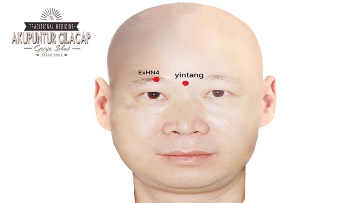Yintang
