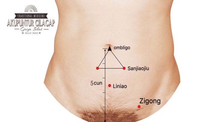 Zigong (EX-CA1)