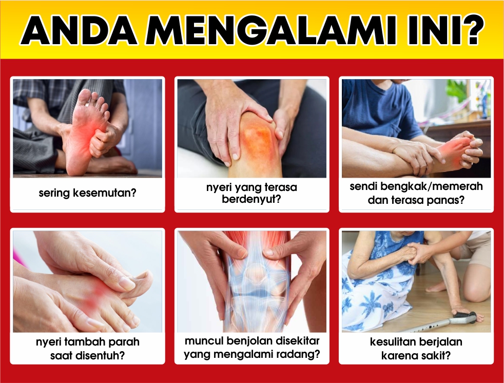 Terapi Akupuntur Cilacap
